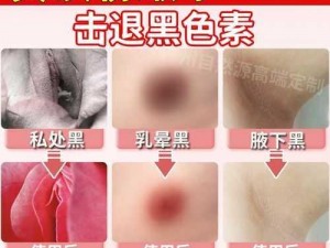 极品粉嫩一线虎白，女性私处美容护理品牌