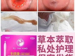 美女阴穴抑菌凝胶，女性健康的私密守护