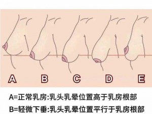 20 岁胸又软又下垂该怎么办？