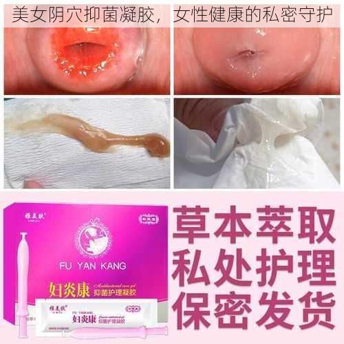 美女阴穴抑菌凝胶，女性健康的私密守护