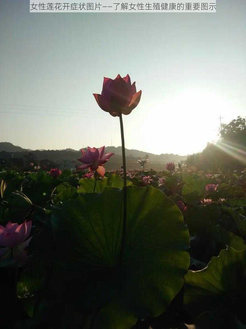 女性莲花开症状图片——了解女性生殖健康的重要图示