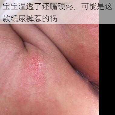 宝宝湿透了还嘴硬疼，可能是这款纸尿裤惹的祸