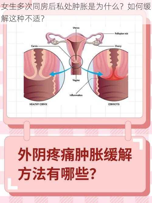 女生多次同房后私处肿胀是为什么？如何缓解这种不适？